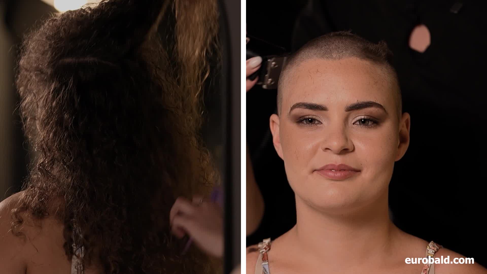 Hannah (before-after)